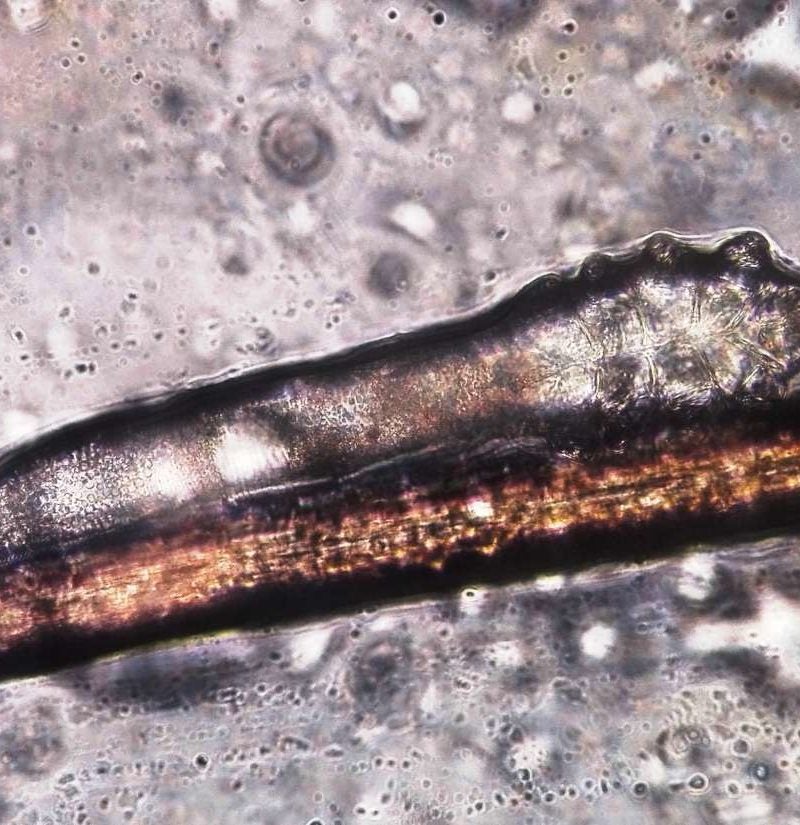 Demodex folliculorum фото