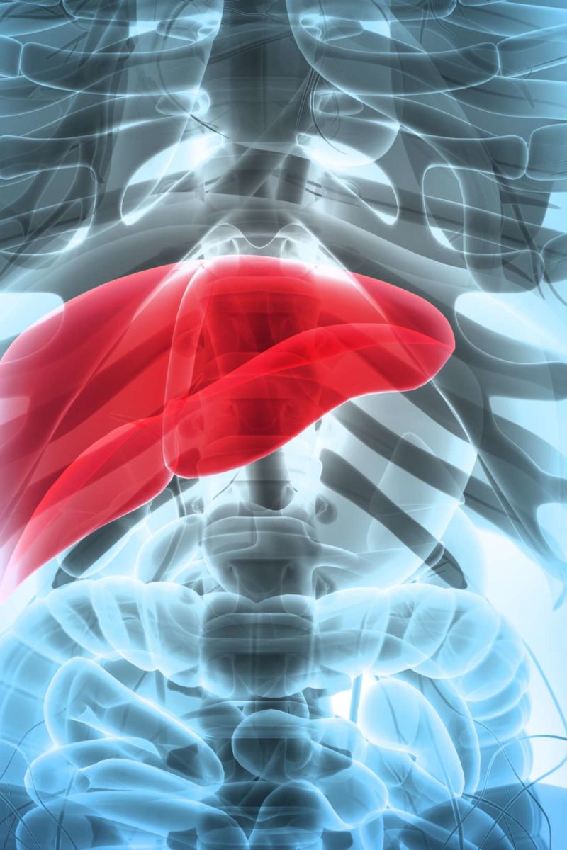 Hepatosplenomegaly Causes Complications And Treatment