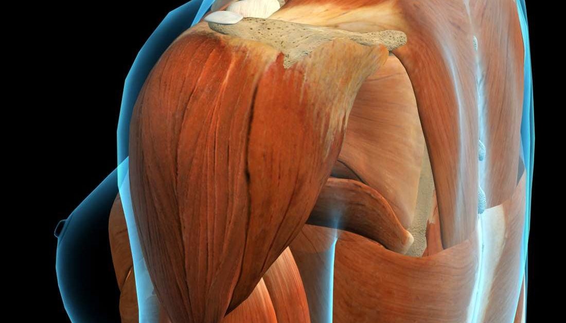 Deltoid pain: Causes, exercises, and relief