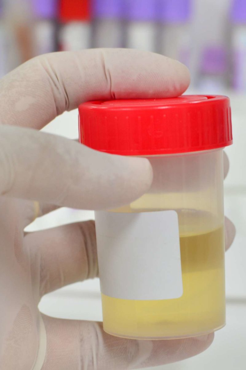 urine specific gravity