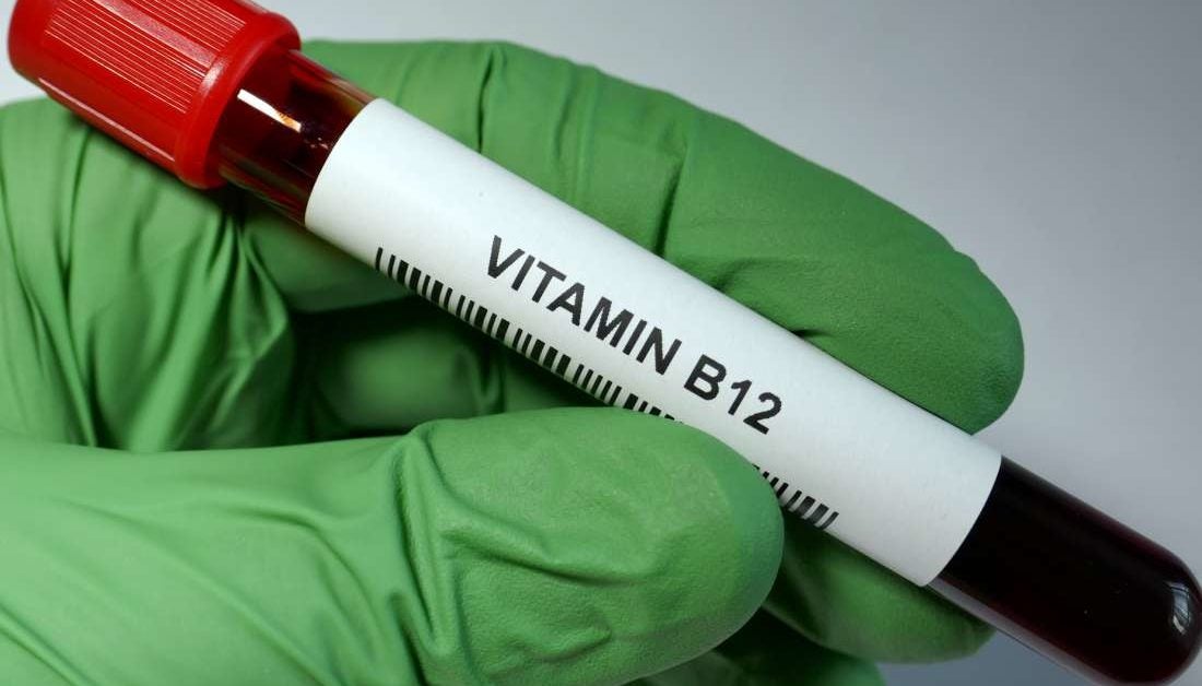 Vitamin B12 level test Uses, normal ranges, and results