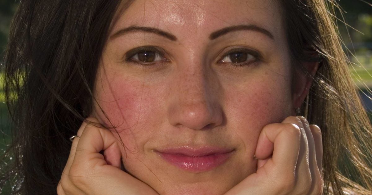 Rosy Cheeks Causes And What To Do