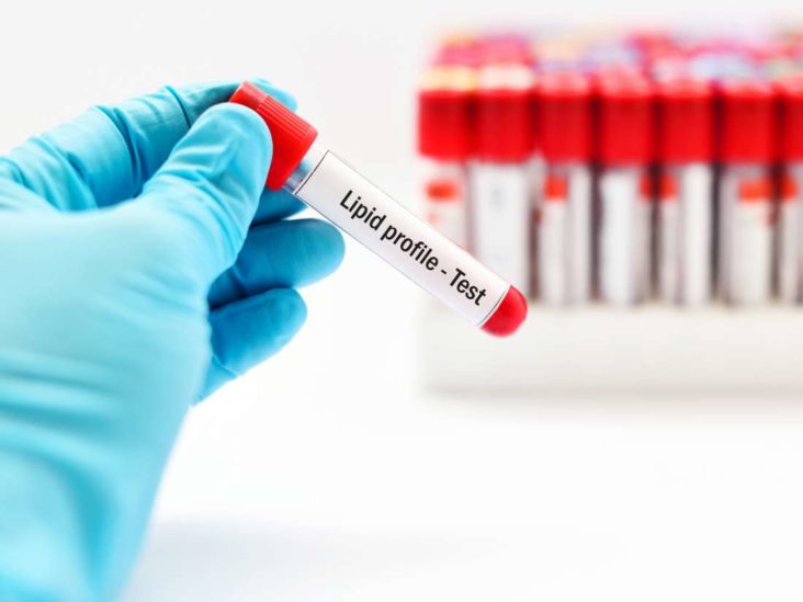 Low Cholesterol Breakfast What You Need To Know