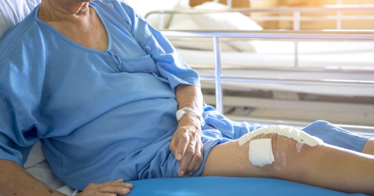 What To Expect After 5 Weeks Of Knee Surgery