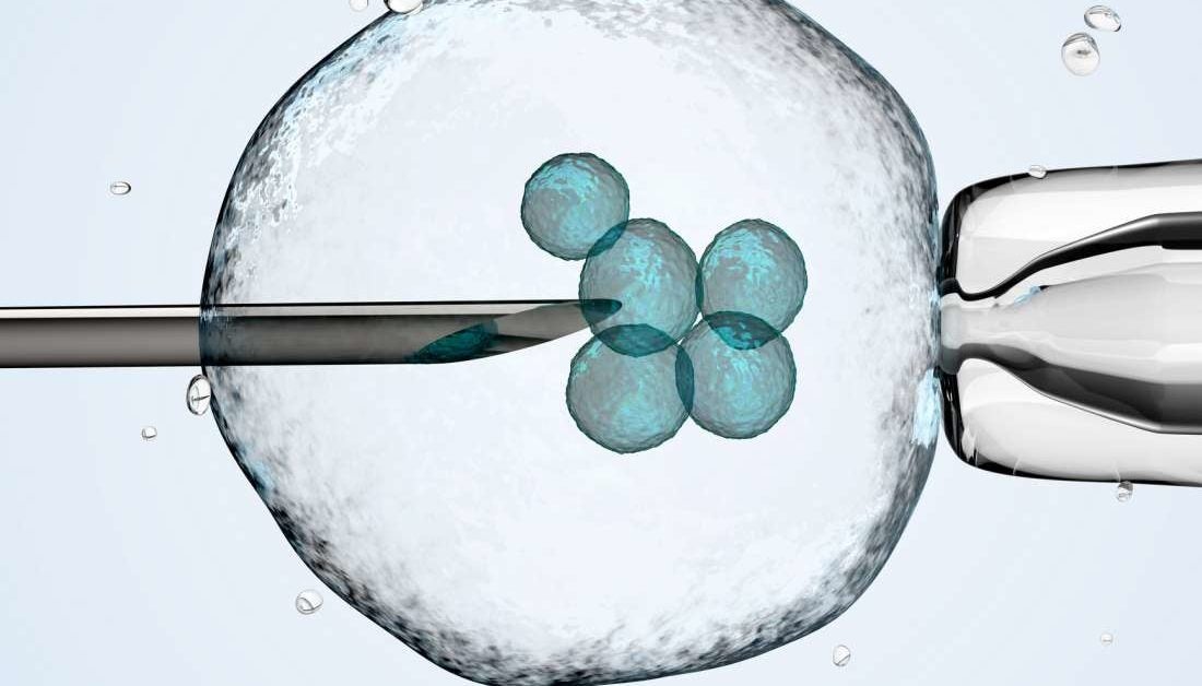 Stem Cell Transplant Slows Down MS Progression