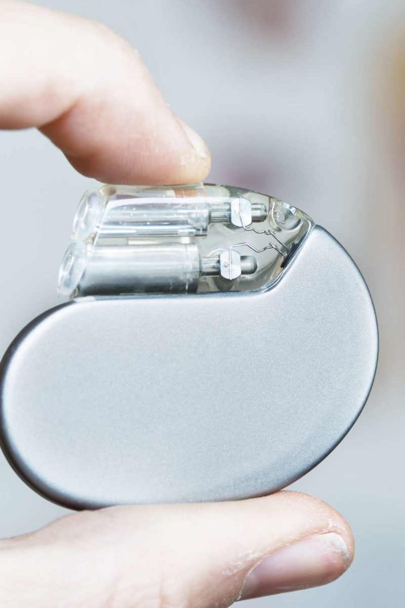 Heart pacemaker surgery Purpose, procedure, and risks