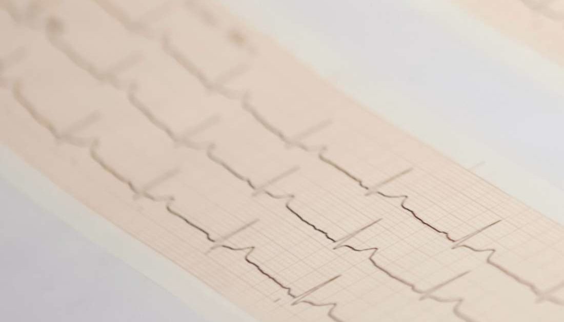 abnormal-ekg-results-causes-and-treatment