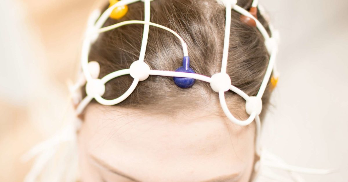 what is an eeg test