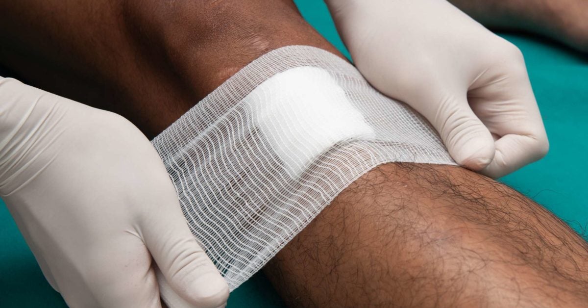 Open wound care: Types, risks, and treatment