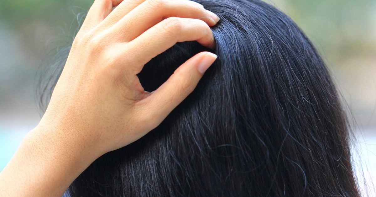 tingling-scalp-causes-symptoms-and-treatment