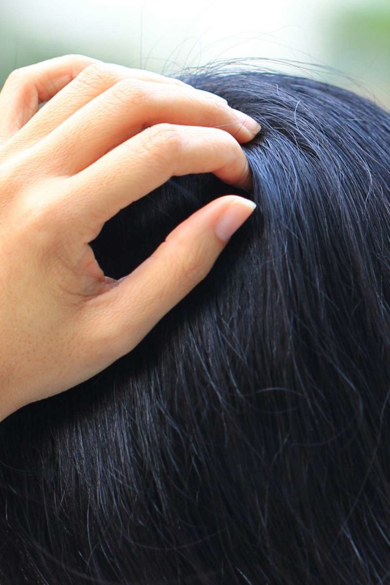 tingling-scalp-causes-symptoms-and-treatment