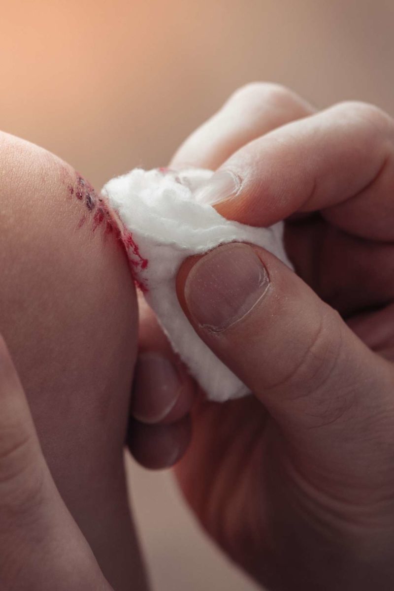 How To Get Rid Of Scabs Fast how to get rid of scabs fast