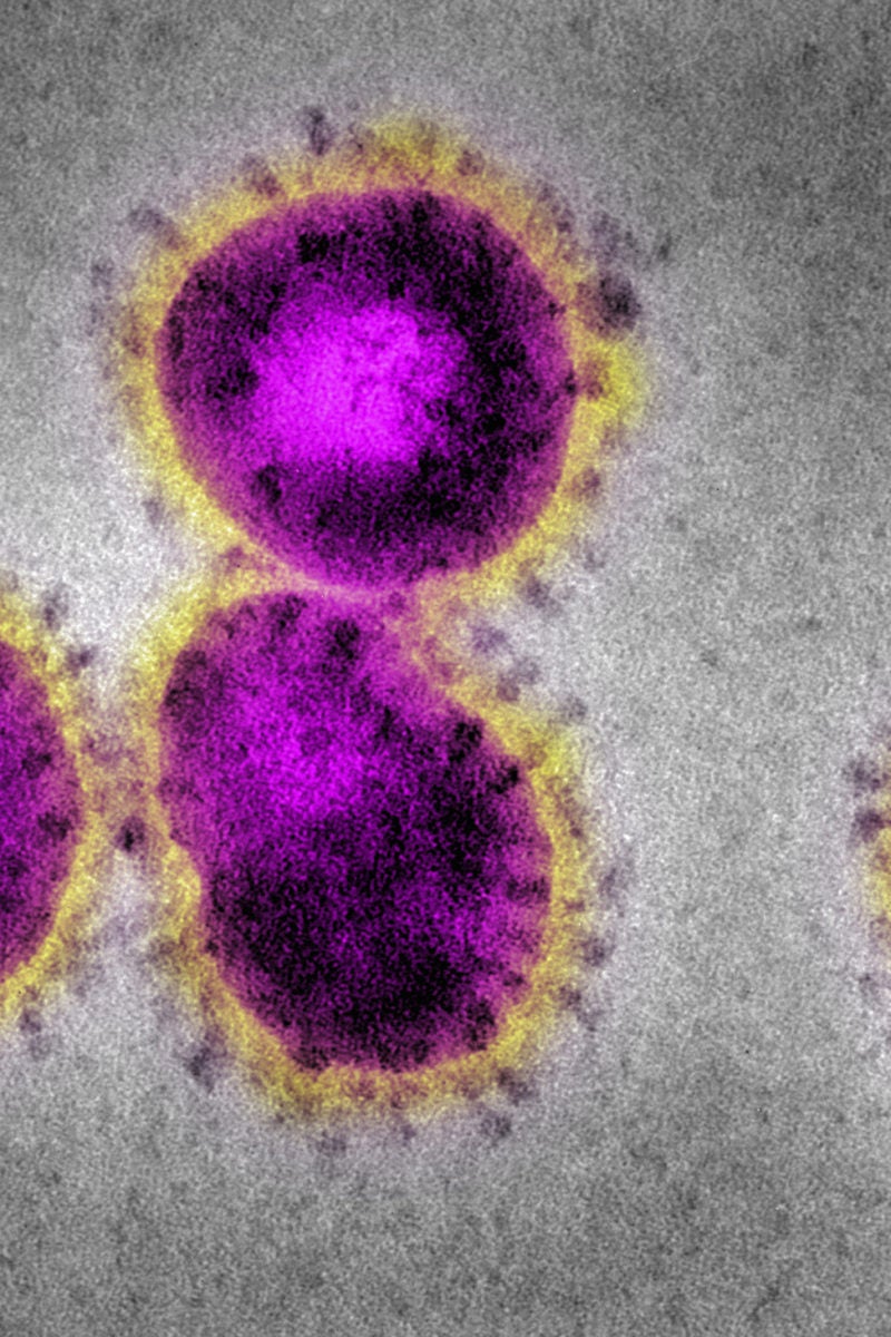How long can coronaviruses survive on surfaces?