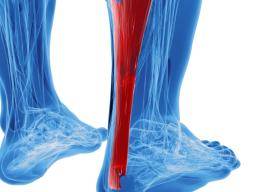 protect achilles tendon while running