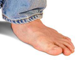 sore flat feet