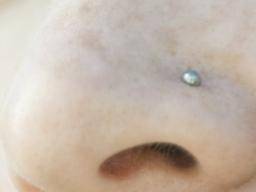Nose piercing bump: Causes and home 