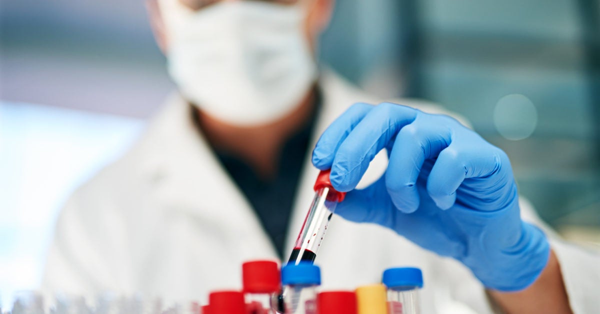 Faulty blood clotting mechanism may explain COVID19 severity