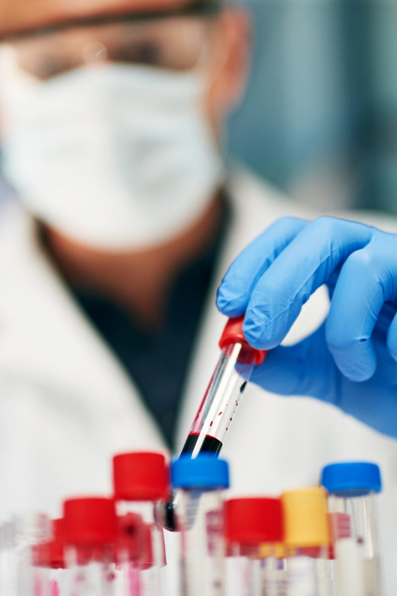 Faulty blood clotting mechanism may explain COVID-19 severity