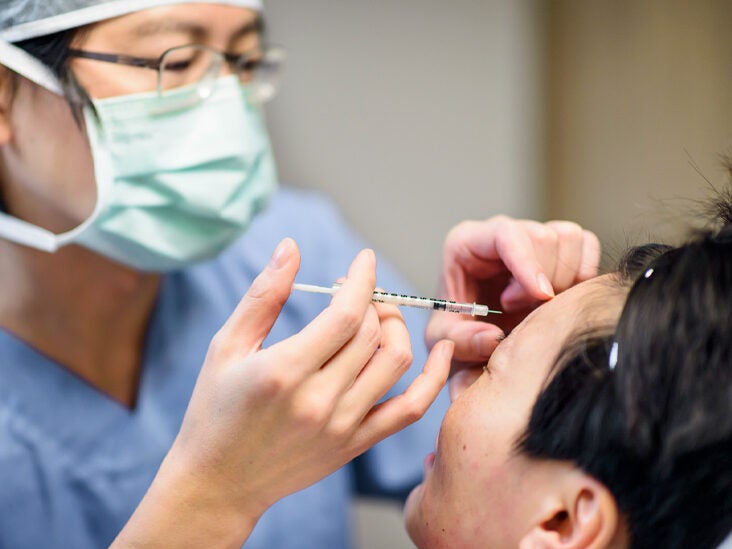 lip flip what it is results side effects and more