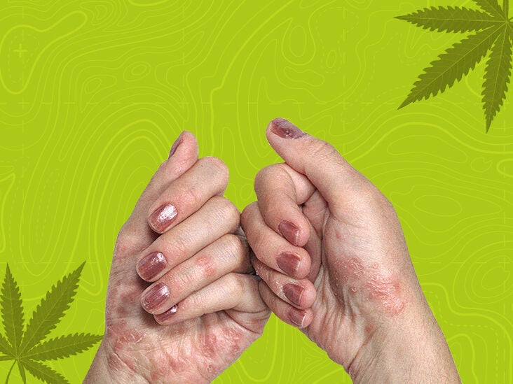 Lockhart family experiences healing effects of CBD oil - kvue.com