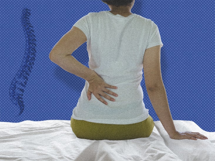 best mattress for spinal cord injury