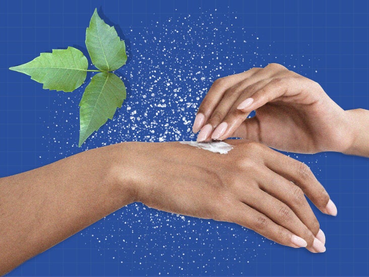 Best Treatment For Poison Ivy Options Prevention And Seeking Help