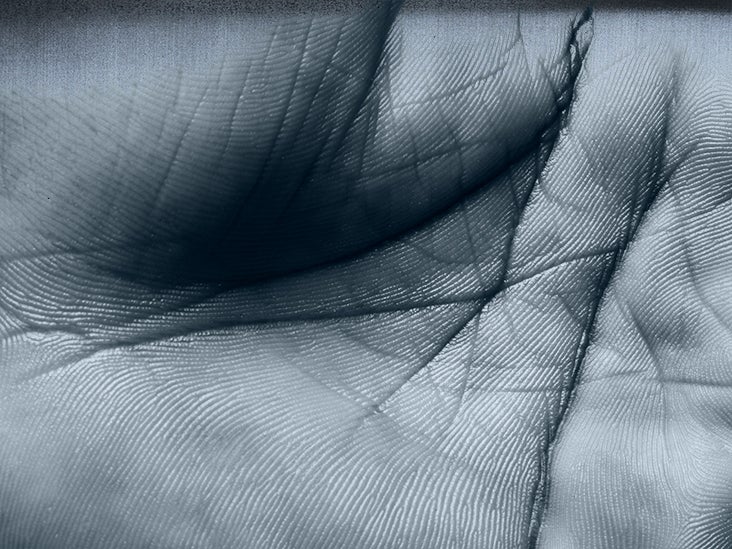 The subcutaneous layer: Anatomy, composition, and functions